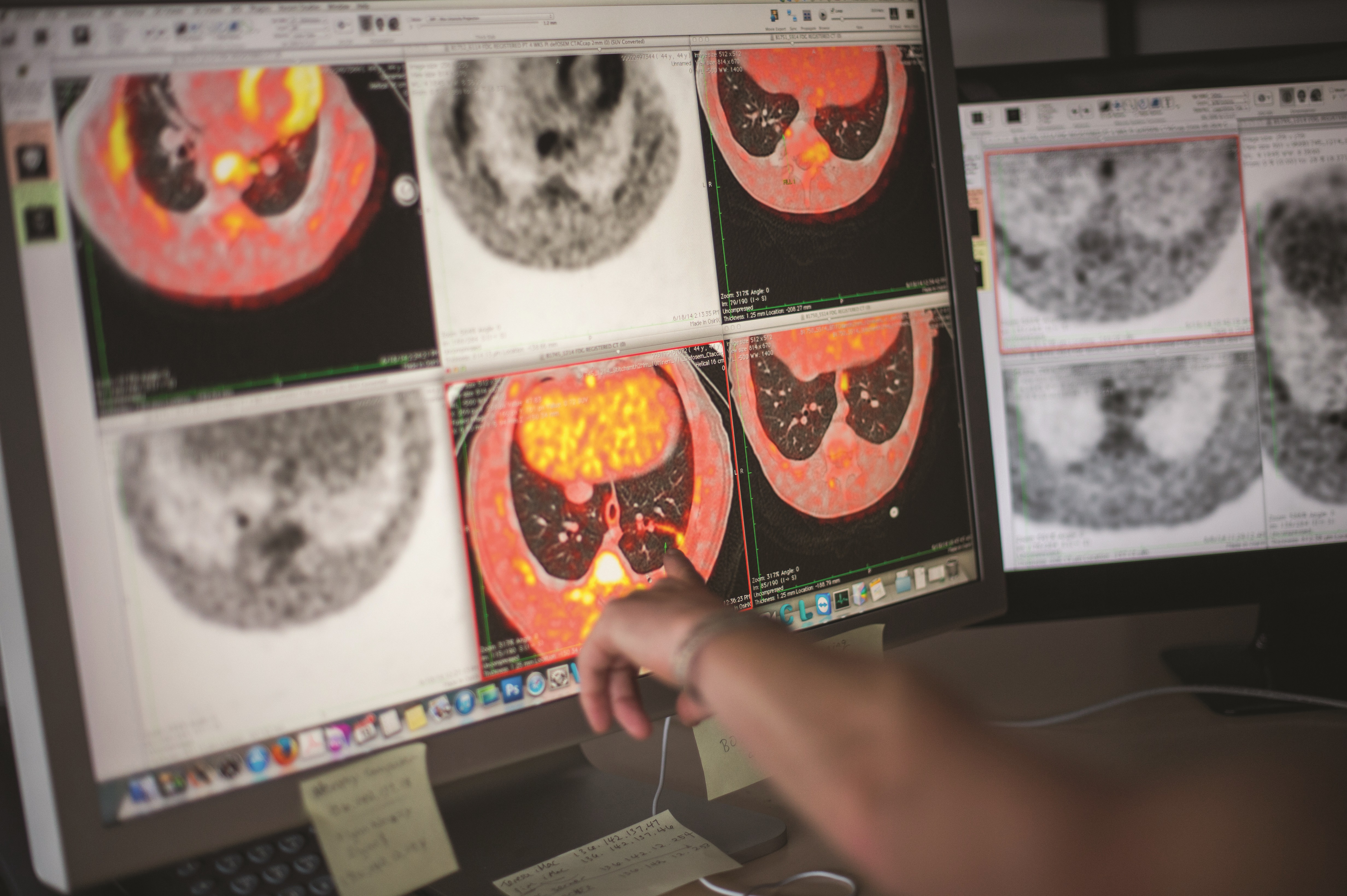 GCGH Retrospectives - Douglas Young