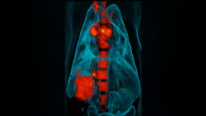/sites/default/files/styles/listing_image/public/Understanding%20Latent%20Tuberculosis%20for%20Drug%20Discovery?itok=sjRhVq46